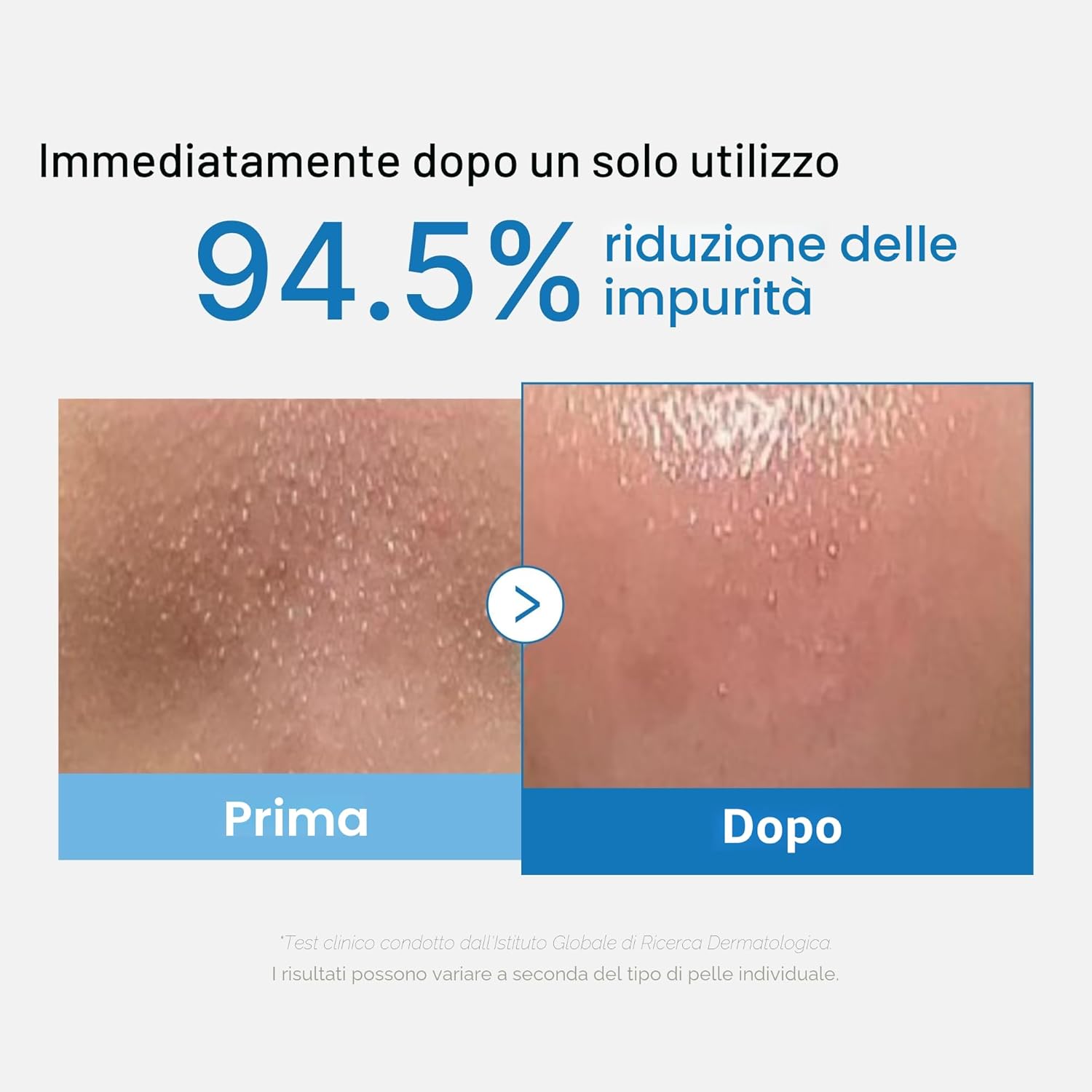 Medicube – Zero Pore Blackhead Deep Cleansing Oil | Olio Detergente Pori K-Beauty