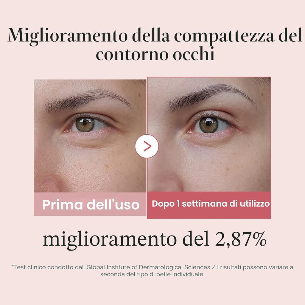 Medicube Eye Serum PDRN Salmone & Pink Peptides — Contorno Occhi Anti-Età
