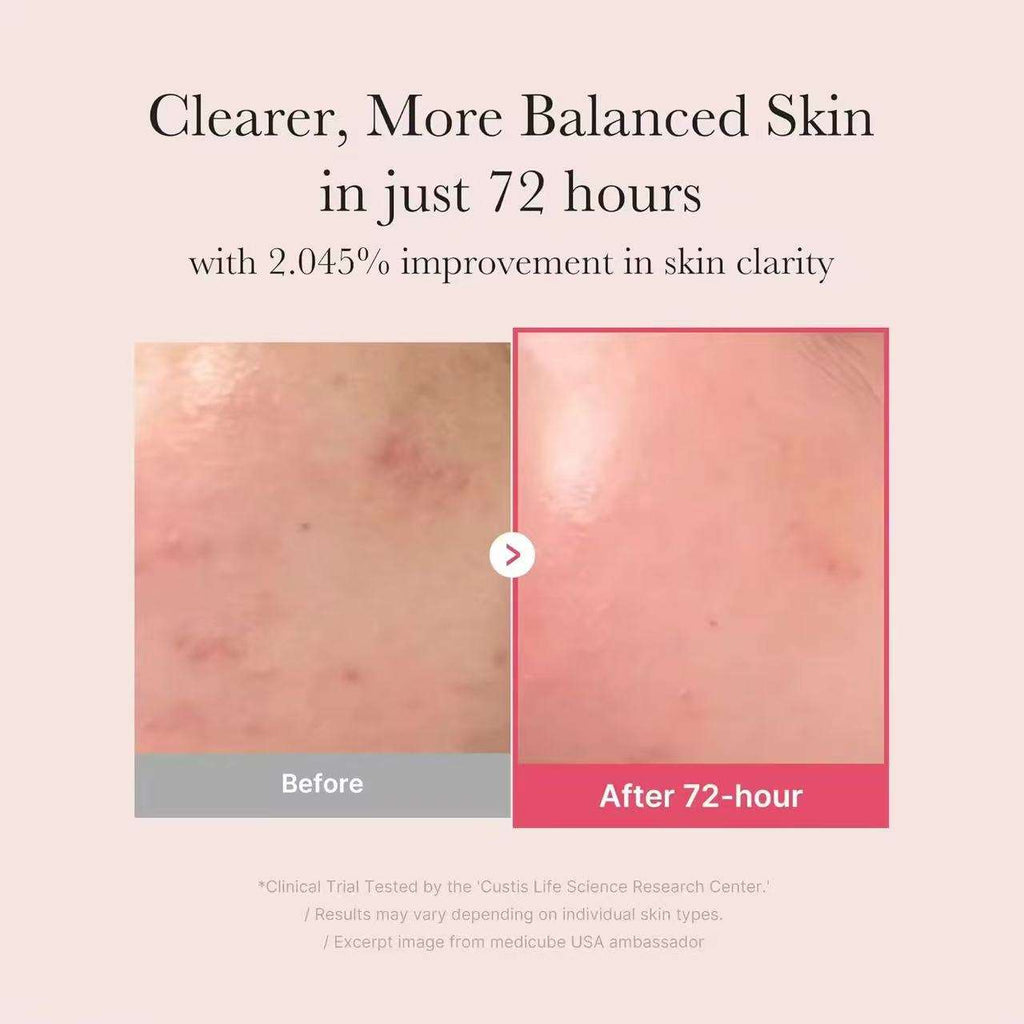 Medicube – TXA + Niacinamide 15 Serum 30ml | Siero Schiarente K-Beauty